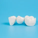 Crownsorg: The Future of Dental Crown Solutions