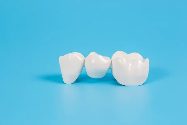 Crownsorg: The Future of Dental Crown Solutions